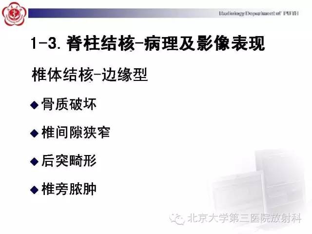 【病例】骨关节结核1例X线CT及MR一例影像表现