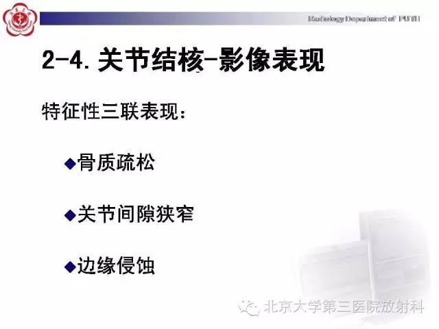 【病例】骨关节结核1例X线CT及MR一例影像表现