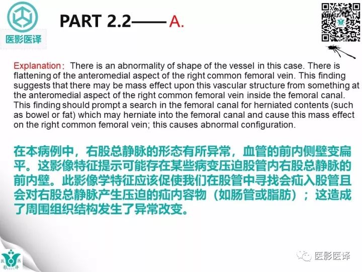 【病例】股疝阑尾炎破裂1例CT影像表现 【病例】股疝阑尾炎破裂1例CT影像表现