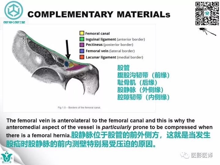 【病例】股疝阑尾炎破裂1例CT影像表现 【病例】股疝阑尾炎破裂1例CT影像表现
