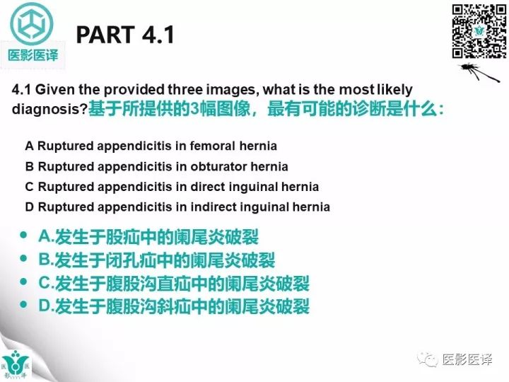 【病例】股疝阑尾炎破裂1例CT影像表现 【病例】股疝阑尾炎破裂1例CT影像表现