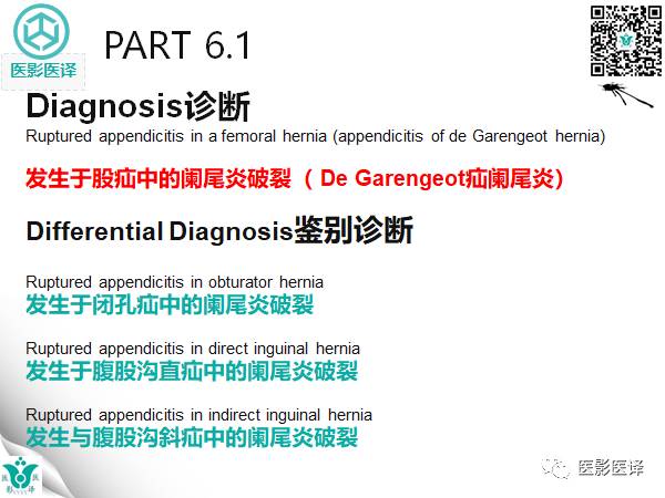 【病例】股疝阑尾炎破裂1例CT影像表现 【病例】股疝阑尾炎破裂1例CT影像表现