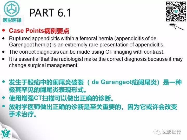 【病例】股疝阑尾炎破裂1例CT影像表现 【病例】股疝阑尾炎破裂1例CT影像表现