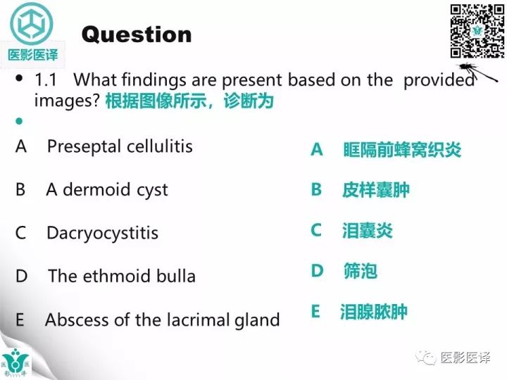 【病例】滥用可卡因致鼻中隔穿孔、全鼻窦炎、泪囊炎1例CT 【病例】滥用可卡因致鼻中隔穿孔、全鼻窦炎、泪囊炎1例CT