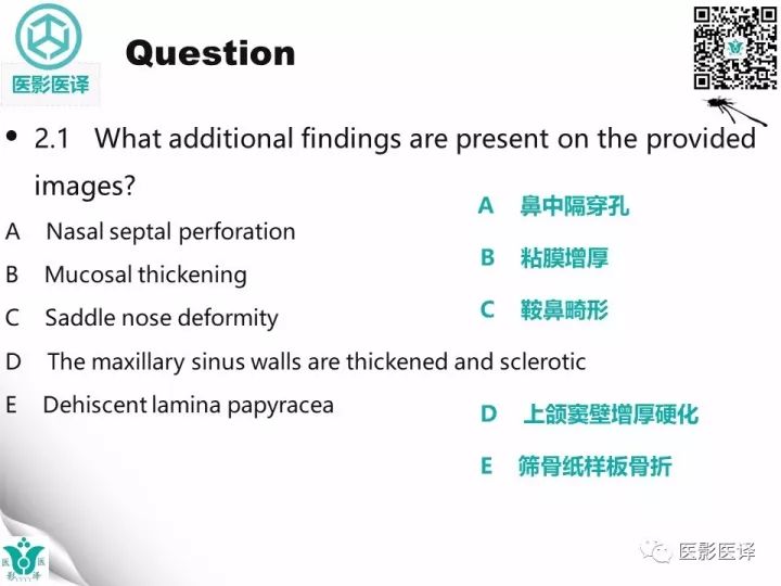 【病例】滥用可卡因致鼻中隔穿孔、全鼻窦炎、泪囊炎1例CT 【病例】滥用可卡因致鼻中隔穿孔、全鼻窦炎、泪囊炎1例CT