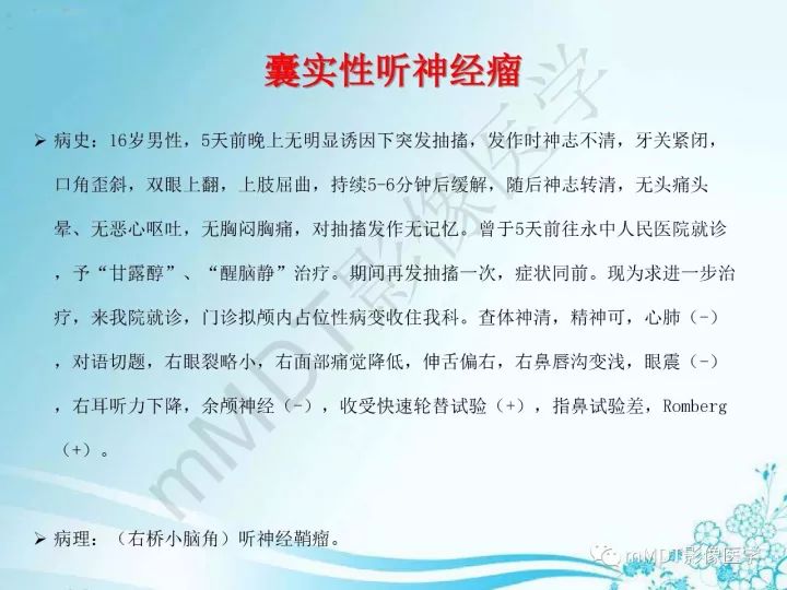 【PPT】听神经鞘瘤