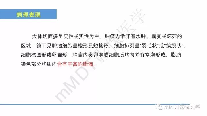 【PPT】常见卵巢性索间质肿瘤