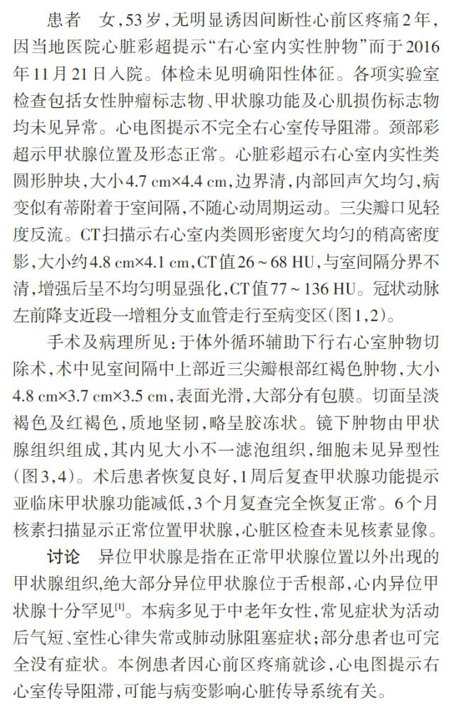 【病例】心内异位甲状腺影像表现一例CT