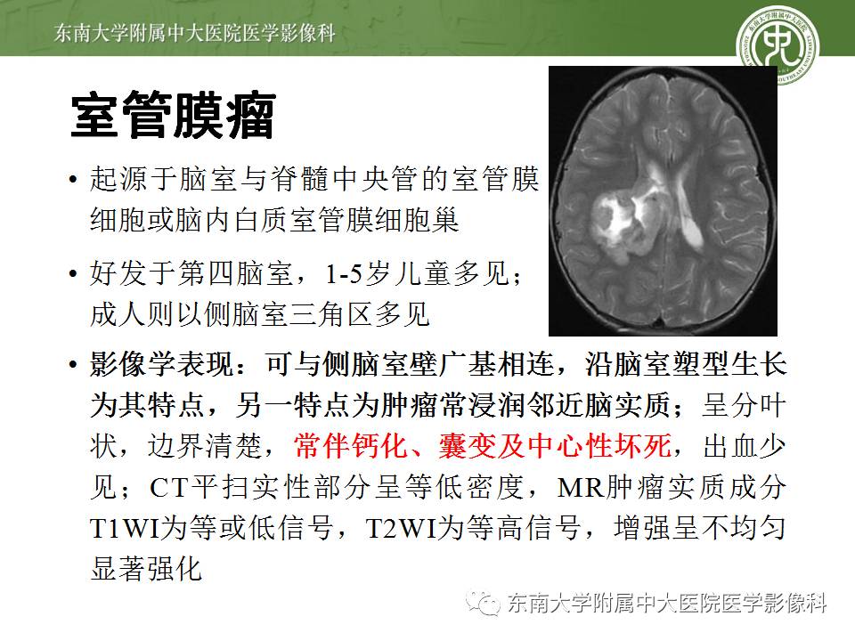 【病例】侧脑室脉络丛乳头状瘤1例MR影像特点