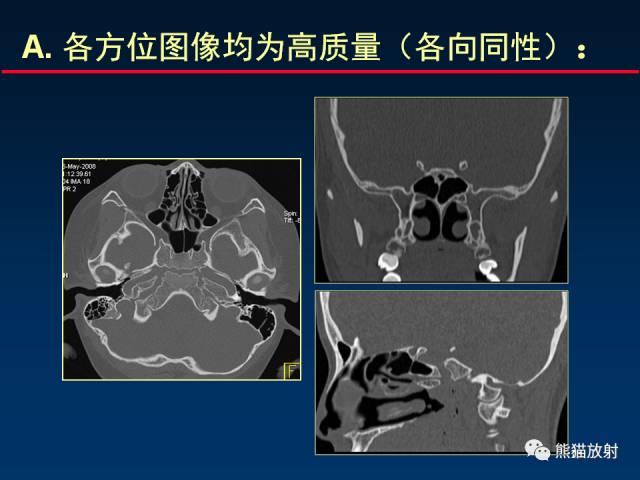 【PPT】MSCT后处理技术在显示翼腭窝解剖中的作用