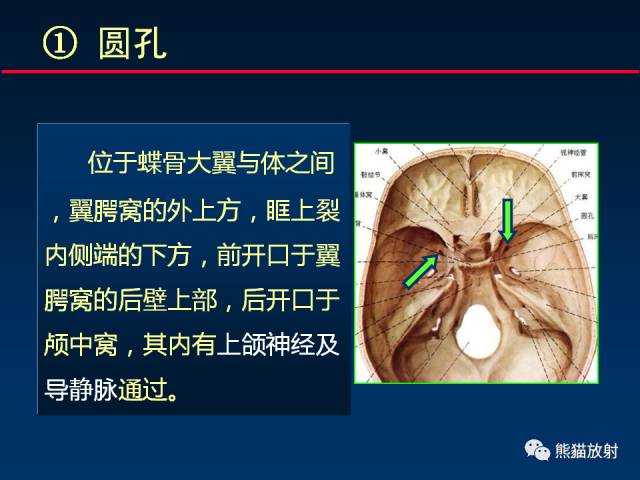 【PPT】MSCT后处理技术在显示翼腭窝解剖中的作用