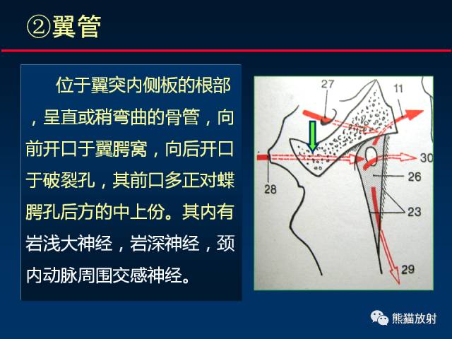 【PPT】MSCT后处理技术在显示翼腭窝解剖中的作用