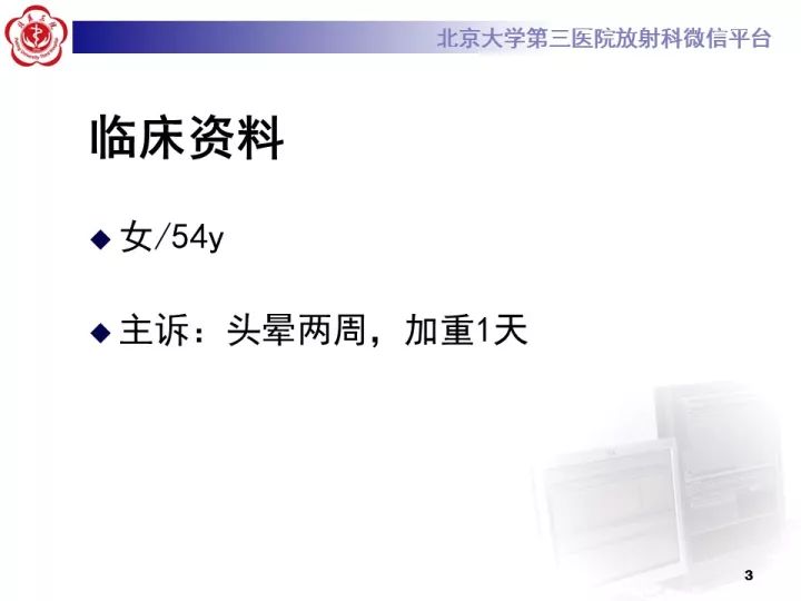 【病例】右额叶灰质异位1例CT及MR