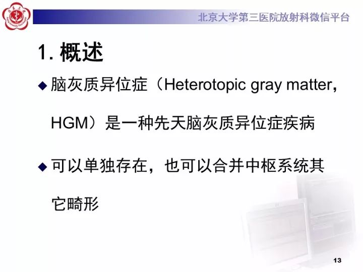【病例】右额叶灰质异位1例CT及MR