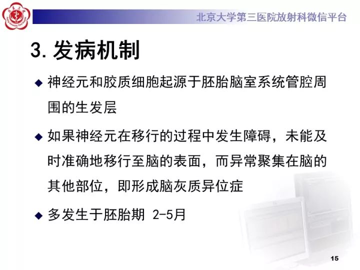 【病例】右额叶灰质异位1例CT及MR