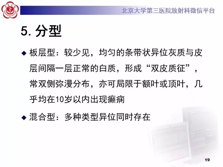 【病例】右额叶灰质异位1例CT及MR