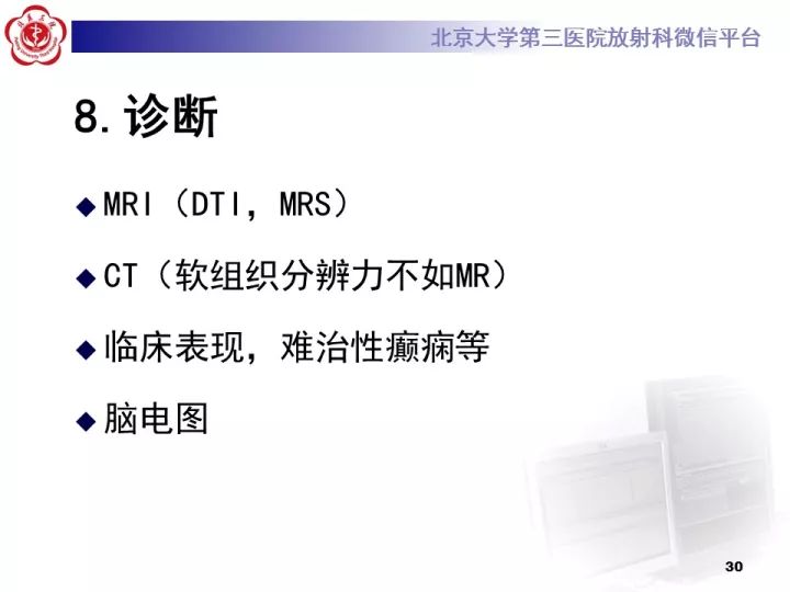 【病例】右额叶灰质异位1例CT及MR