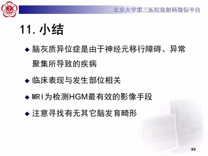 【病例】右额叶灰质异位1例CT及MR