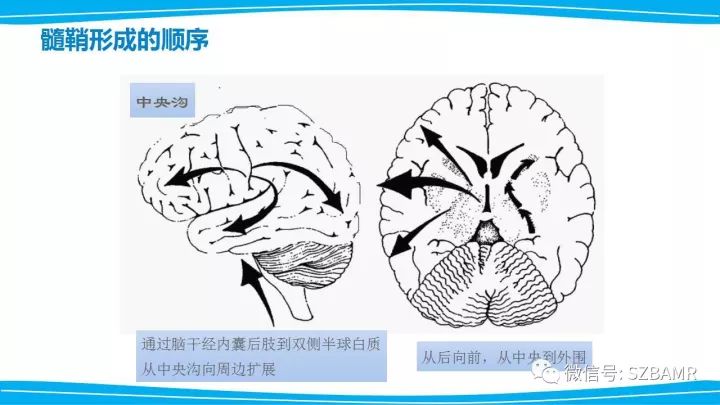 【PPT】新生儿缺氧缺血性脑病（HIE）的MRI诊断