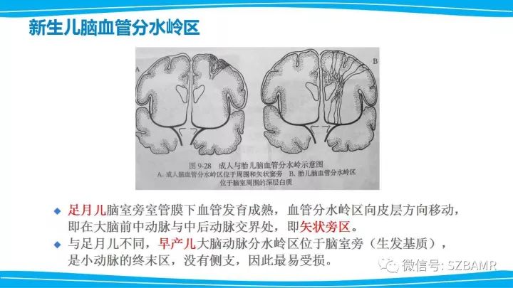 【PPT】新生儿缺氧缺血性脑病（HIE）的MRI诊断