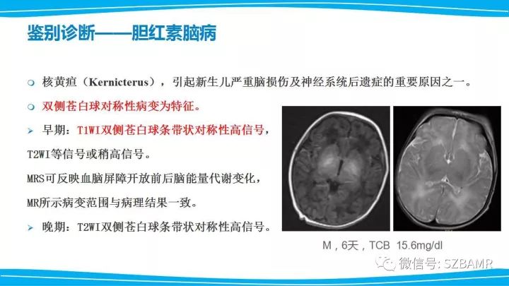 【PPT】新生儿缺氧缺血性脑病（HIE）的MRI诊断