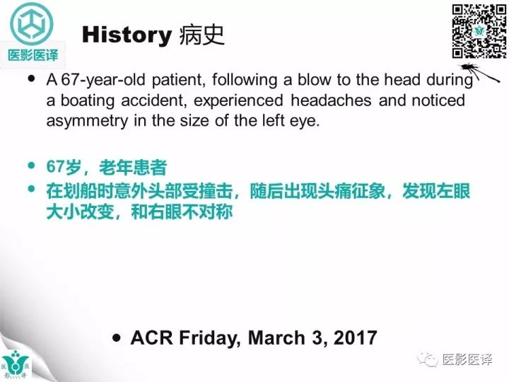 【病例】眶板断裂1例CT影像表现