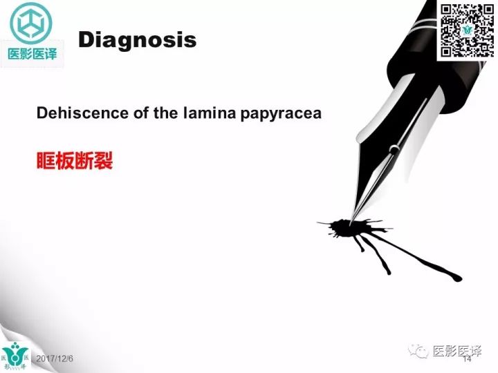 【病例】眶板断裂1例CT影像表现