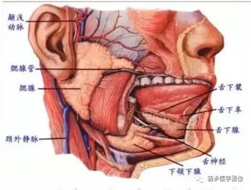 【病例】腮腺多形性腺瘤1例CT影像表现