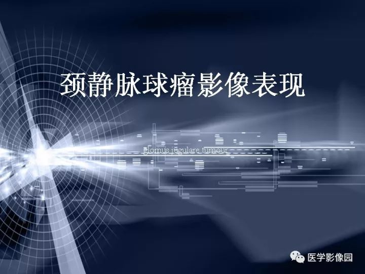 【PPT】颈静脉球瘤影像表现