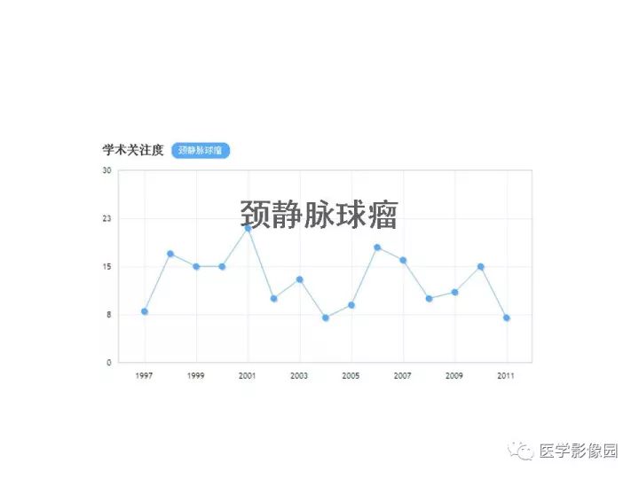 【PPT】颈静脉球瘤影像表现