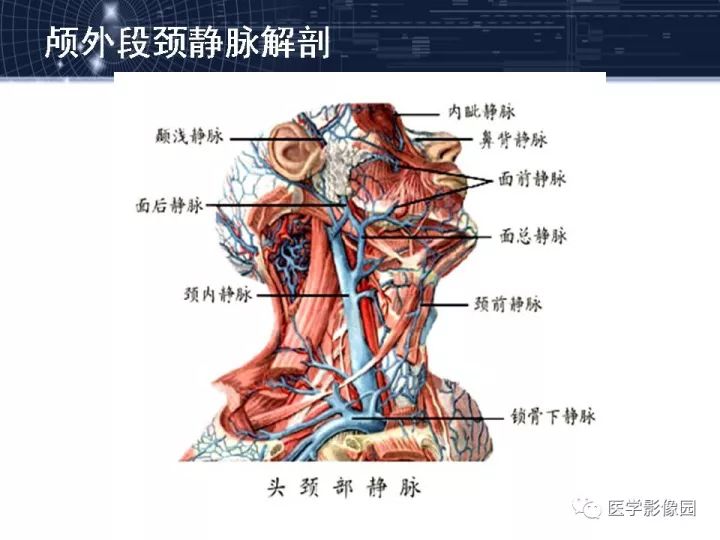 【PPT】颈静脉球瘤影像表现