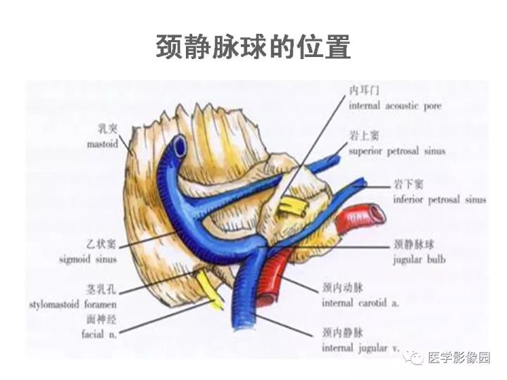 【PPT】颈静脉球瘤影像表现