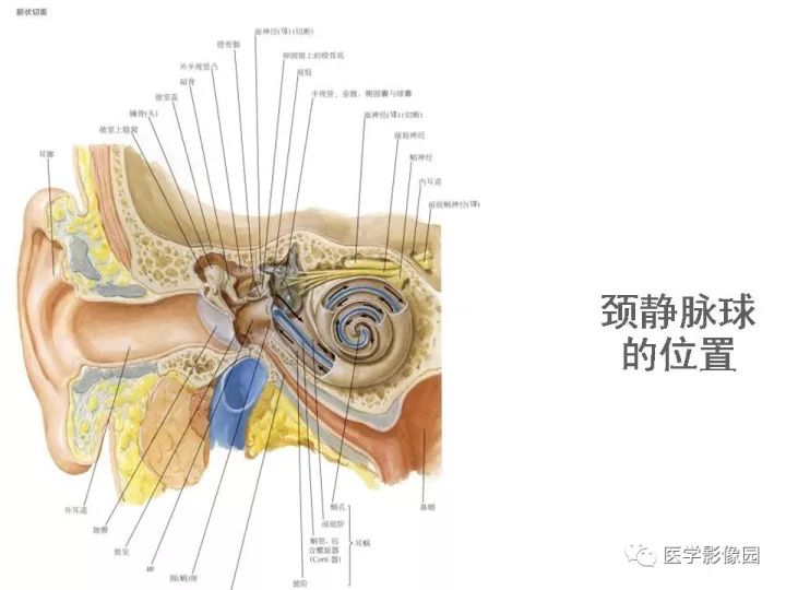 【PPT】颈静脉球瘤影像表现