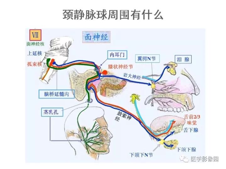 【PPT】颈静脉球瘤影像表现
