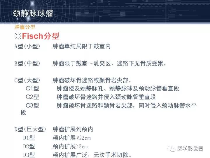 【PPT】颈静脉球瘤影像表现