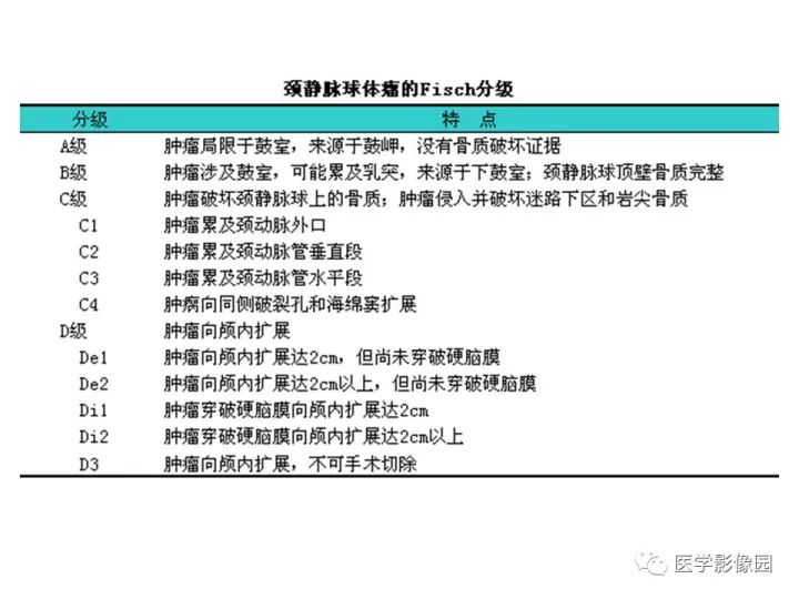 【PPT】颈静脉球瘤影像表现