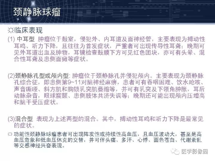 【PPT】颈静脉球瘤影像表现