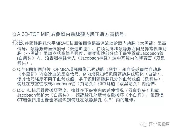 【PPT】颈静脉球瘤影像表现