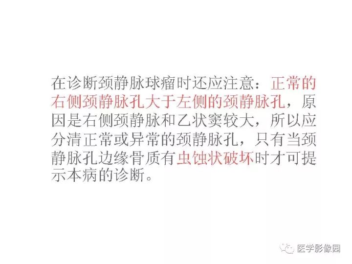 【PPT】颈静脉球瘤影像表现