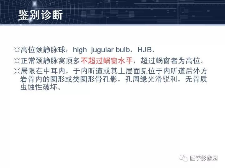 【PPT】颈静脉球瘤影像表现