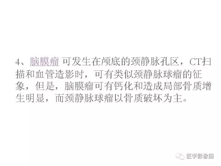 【PPT】颈静脉球瘤影像表现