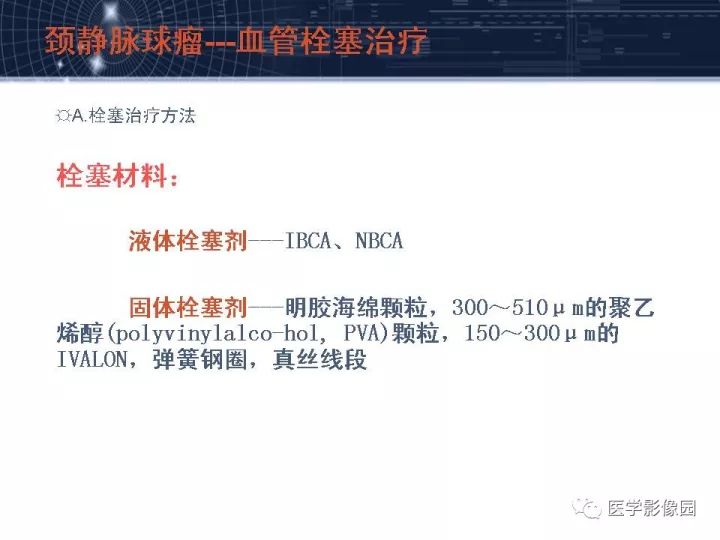 【PPT】颈静脉球瘤影像表现