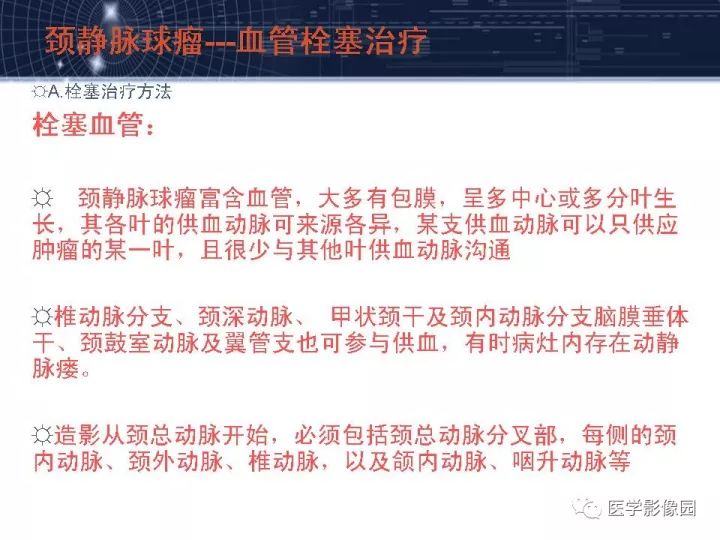 【PPT】颈静脉球瘤影像表现
