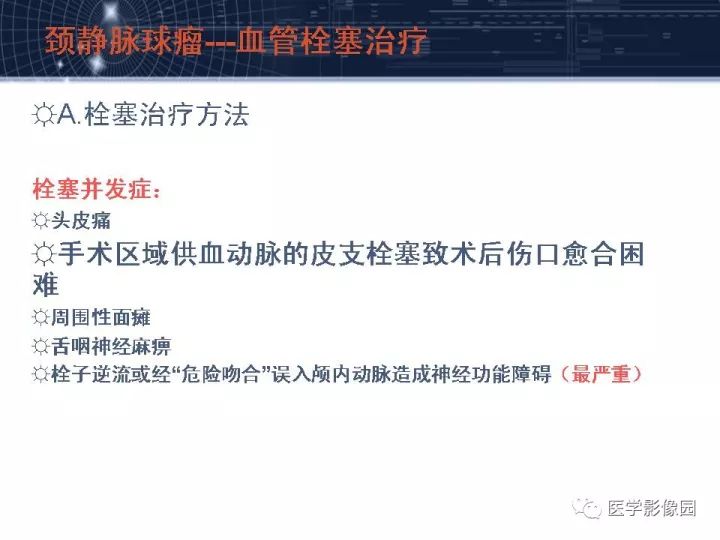 【PPT】颈静脉球瘤影像表现