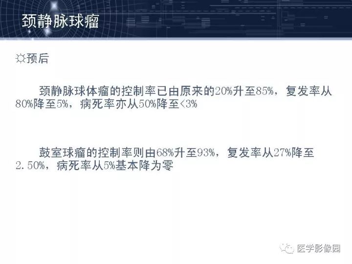 【PPT】颈静脉球瘤影像表现