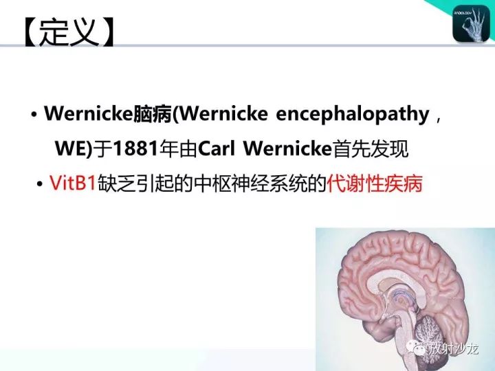 【病例】Wernicke脑病1例MR