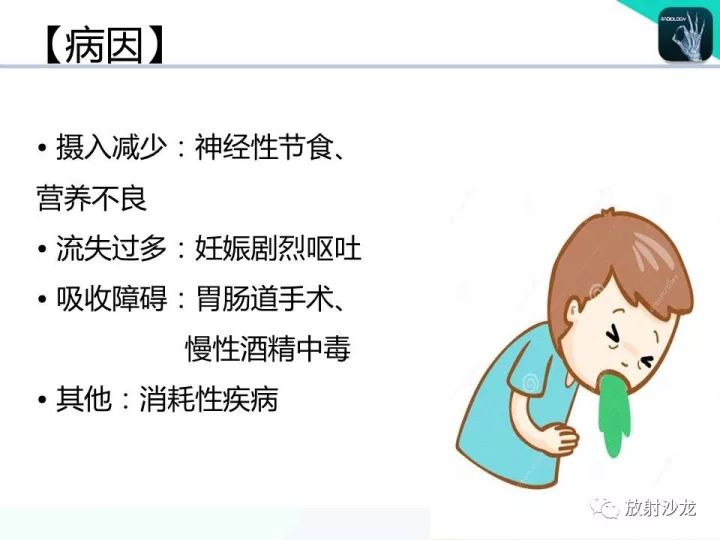 【病例】Wernicke脑病1例MR