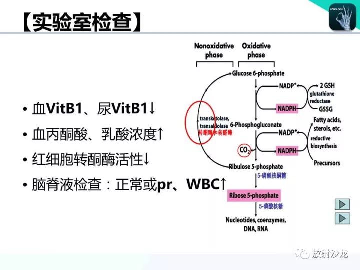 【病例】Wernicke脑病1例MR