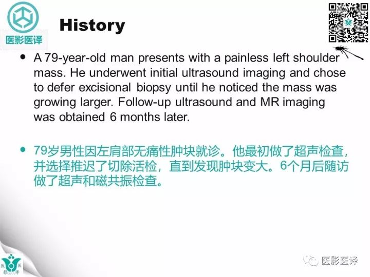【病例】肩锁关节囊肿—喷泉征1例MR