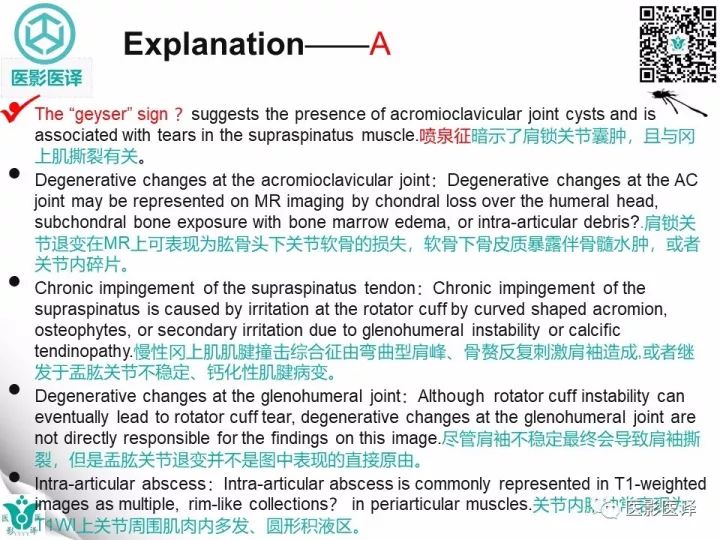 【病例】肩锁关节囊肿—喷泉征1例MR